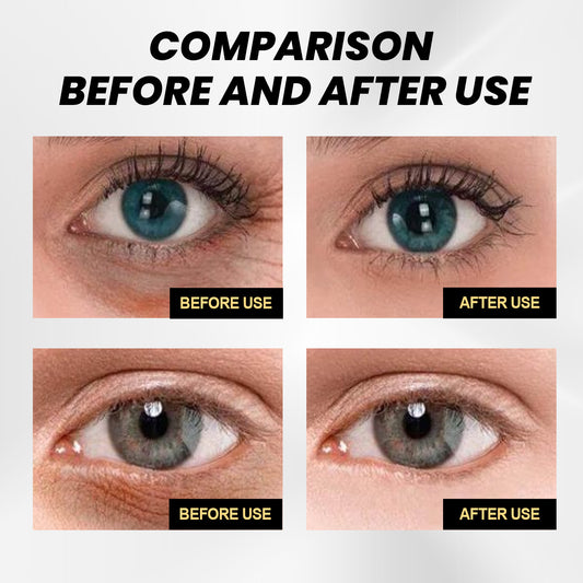 Creme de Olhos Hidratante EELHOE — Nutrição e Frescura