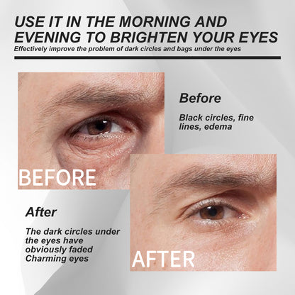 Creme de Olhos Masculino Anti-Olheiras e Anti-Inchaço